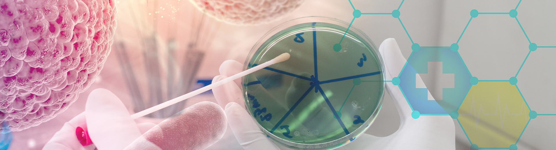 微生物培養整體解決方案